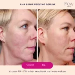 Flow Cosmetics - AHA & BHA Peeling Serum 30ml - Afbeelding 4