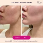 Flow Cosmetics - AHA & BHA Peeling Serum 30ml - Afbeelding 6