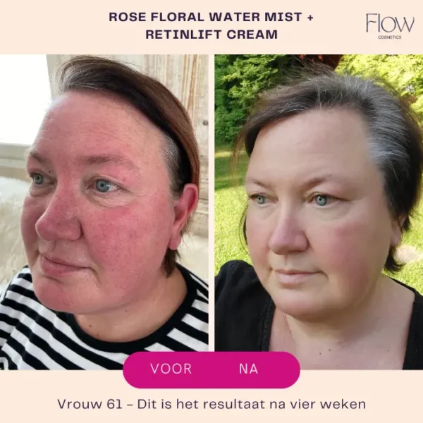 Flow Cosmetics - RetinLift 3-in-1 - Retinol creme - Afbeelding 5