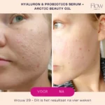 Flow  Cosmetics - Hyaluron & Probiotics - Serum - Afbeelding 4