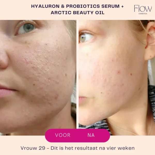 Flow  Cosmetics - Hyaluron & Probiotics - Serum - Afbeelding 4