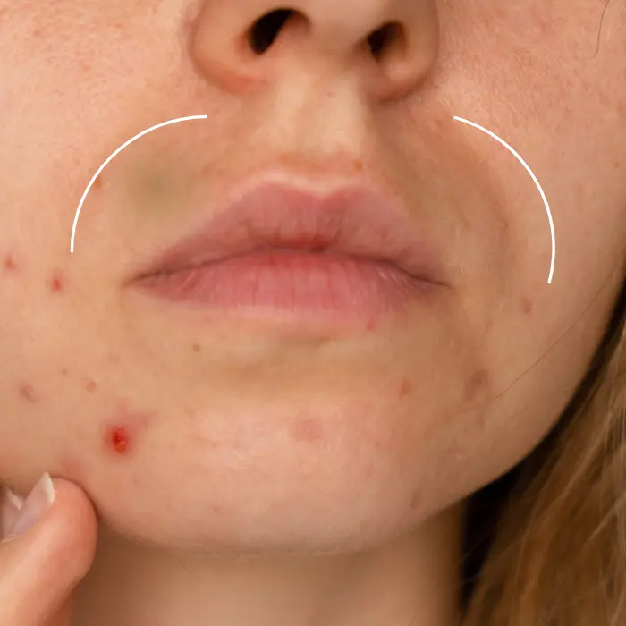 Hars-producten-kopen Hars producten kopen