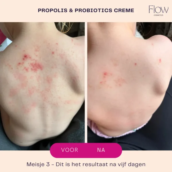 Flow Cosmetics - Propolis & Probiotics Rescue Cream 30ml - Afbeelding 3